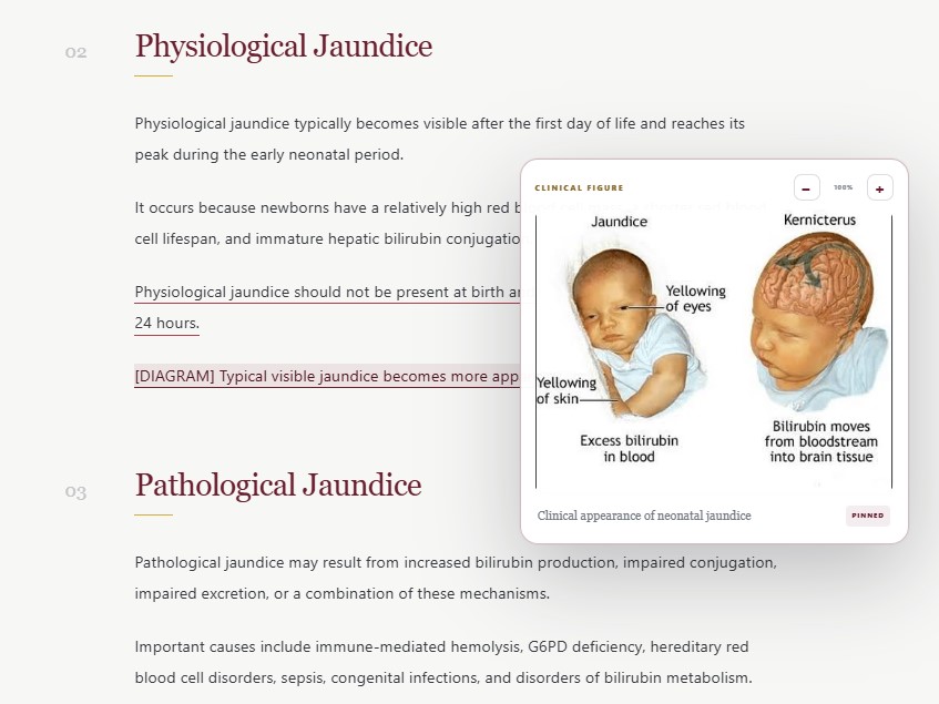 Osmond Medical Library — Neonatal Jaundice